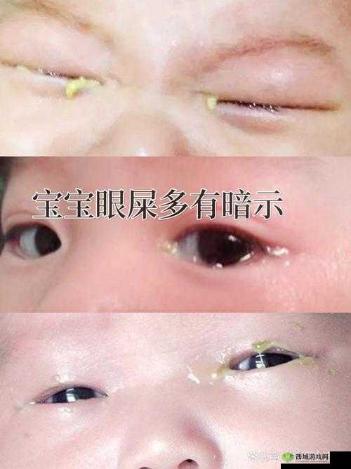 宝宝下面湿透了还嘴硬怎么回事儿：原因大揭秘